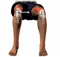 痛風吃什么藥，痛風吃什么藥效果最好