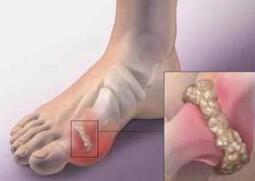 風定寧怎么用，風定寧需要加量嗎