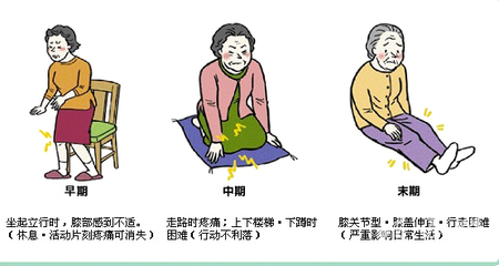 伊索佳購買，硫酸氨基葡萄糖生產廠家