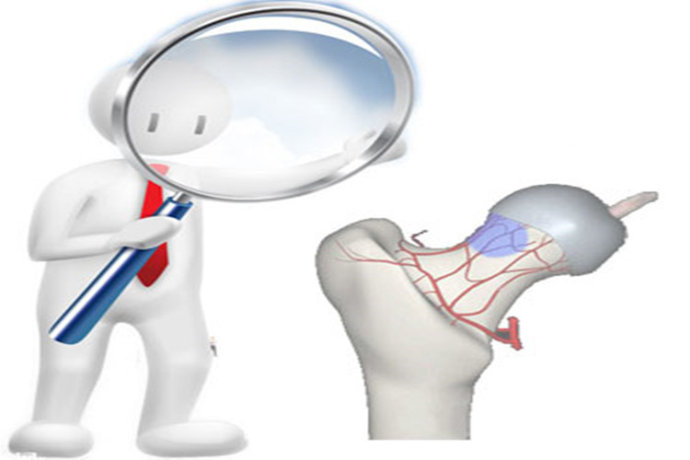 通絡生骨膠囊有哪些特色，股骨頭壞死吃什么藥好