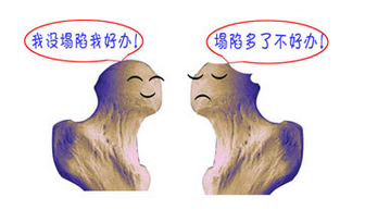 股骨頭壞死吃什么藥好？股骨頭壞死藥物