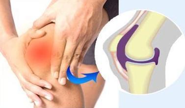 通絡(luò)生骨膠囊早期怎么使用，通絡(luò)生骨膠囊在股骨頭壞死的中期的使用方法