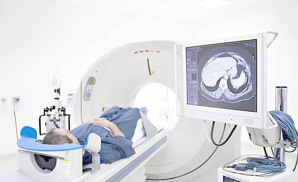 伊索佳副作用，服用伊索佳不能吃什么