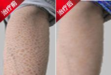 參歸潤燥搽劑杭州有賣嗎，參歸潤燥搽劑購買