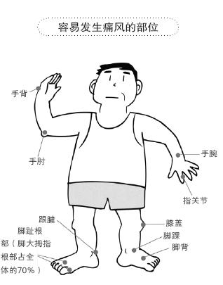 風(fēng)定寧怎么用，風(fēng)定寧作用好嗎