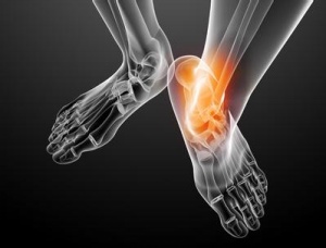 痛風病食物，風定寧使用療程