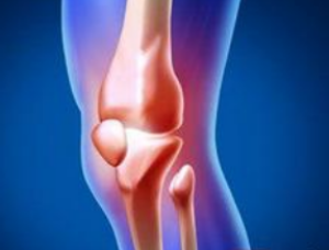 通絡生骨膠囊服用方法，股骨頭壞死治療期間服用注意事項