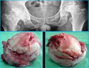 通絡生骨膠囊多少錢一盒，通絡生骨膠囊價格