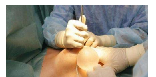 一顆萬(wàn)艾可多少錢，藥店萬(wàn)艾可多少錢