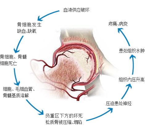 通絡(luò)生骨膠囊多少錢一盒，通絡(luò)生骨膠囊在哪里購(gòu)買