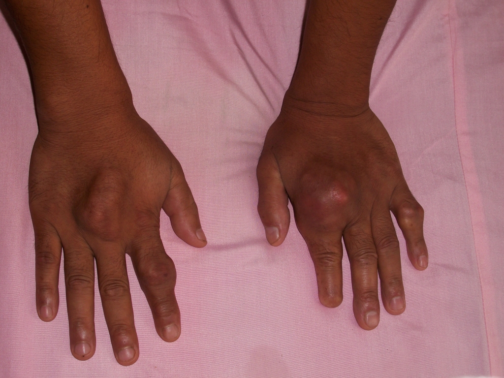 風定寧怎么用,風定寧需要加量嗎