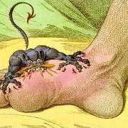 非布司他片說明書,風定寧和優立通是一樣的嗎