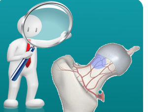 什么是股骨頭壞死，股骨頭壞死吃什么藥好