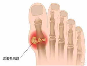 風定寧怎么用，風定寧需要加量嗎