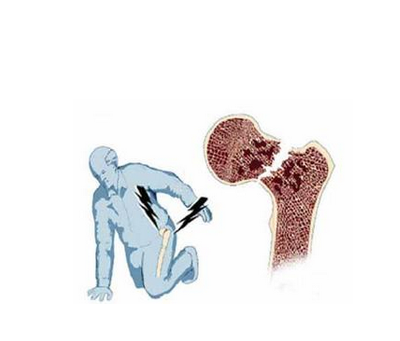 通絡生骨膠囊多少錢一盒，通絡生骨膠囊價格