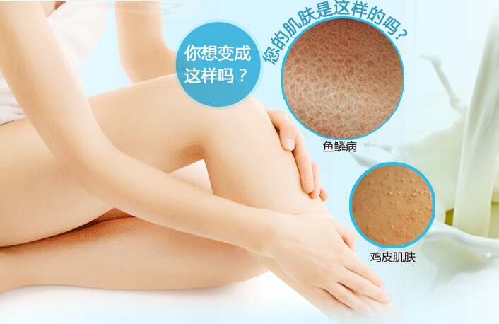 治魚鱗病吃什么藥，治療魚鱗病吃什么藥好