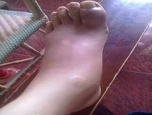 風(fēng)定寧怎么用，風(fēng)定寧需要加量嗎