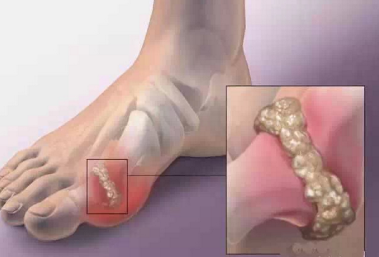 風(fēng)定寧怎么用，風(fēng)定寧療程