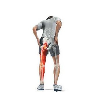 股骨頭壞死的治療，什么是股骨頭壞死