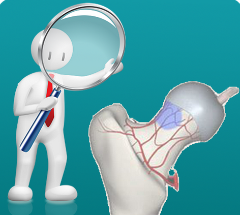 股骨頭壞死的治療，什么是股骨頭壞死