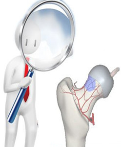 股骨頭壞死每個(gè)分期怎么治療,通絡(luò)生骨膠囊有什么作用