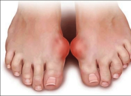 風定寧片價格,風定寧哪里有賣