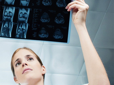 什么是股骨頭壞死,股骨頭壞死有哪幾個(gè)分期