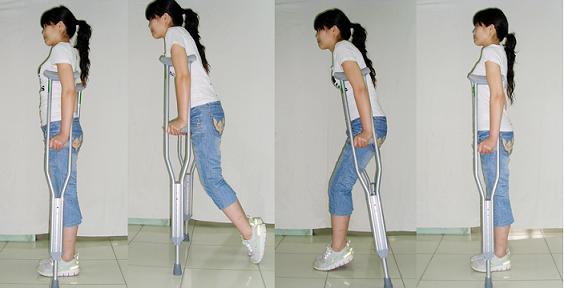 股骨頭壞死的治療,什么是股骨頭壞死