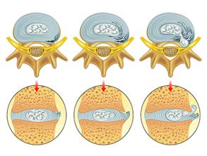 好及施使用注意，貼膏藥后火辣辣的