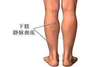 邁之靈片禁忌，邁之靈不良反應