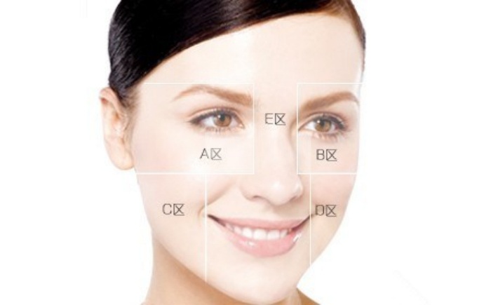 黃褐斑的類型，妥塞敏 美白