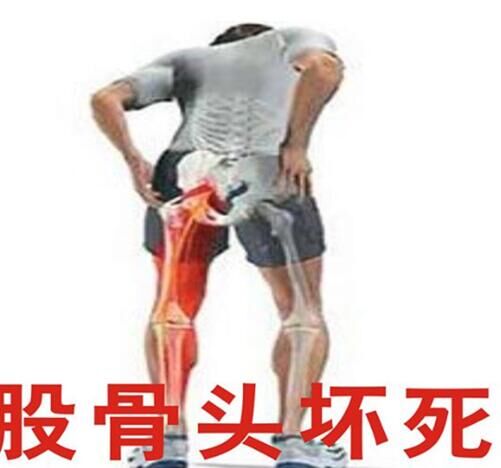 股骨頭壞死治療期間服用注意事項,通絡生骨膠囊療程是多久