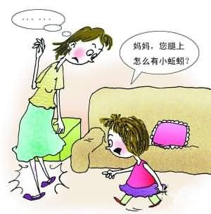 靜脈曲張的病因，邁之靈消腫曲張