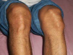 風(fēng)定寧怎么用,風(fēng)定寧需要加量嗎