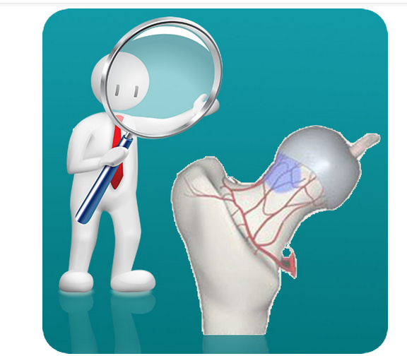 什么是股骨頭壞死,股骨頭壞死的分類