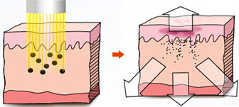  妥塞敏價(jià)格，妥塞敏廠家