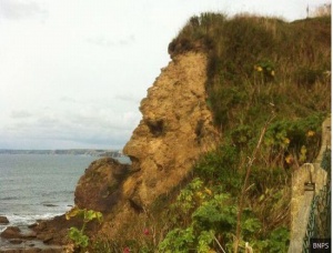 糖尿病視網膜病變吃什么藥，芪明顆粒效果好嗎