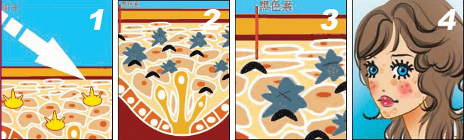 黃褐斑的病因，妥塞敏淡斑一天吃幾粒