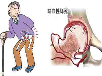 通絡生骨膠囊效果咋樣,通絡生骨膠囊好不好