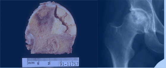 通絡(luò)生骨膠囊，通絡(luò)生骨膠囊效