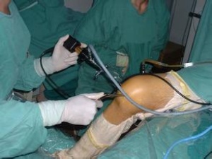 股骨頭壞死有哪幾個分期，股骨頭壞死每個分期怎么治療