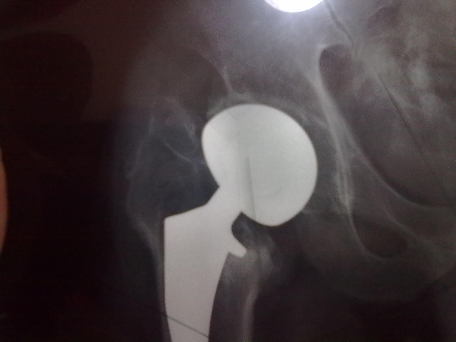 金戈如何服用，枸櫞酸西地那非片怎么使用