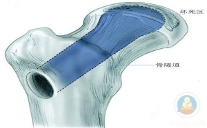 通絡(luò)生骨膠囊網(wǎng)上可買到嗎，通絡(luò)生骨膠囊價格是多少