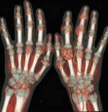 風(fēng)定寧片價格，風(fēng)定寧廠家