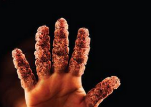 風定寧片價格，非布司他片哪里能買到正品