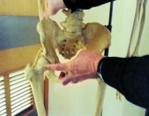 通絡生骨膠囊服用方法，股骨頭壞死治療期間服用注意事項