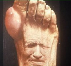 風定寧怎么用，風定寧需要加量嗎