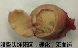 通絡生骨膠囊成分，通絡生骨膠囊療效