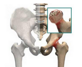 通絡生骨膠囊成分，通絡生骨膠囊好不好