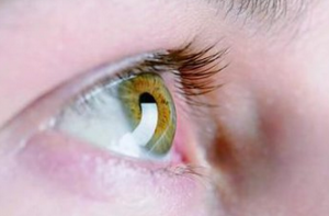 糖尿病眼底視網膜病變，糖尿病視網膜病變吃什么藥